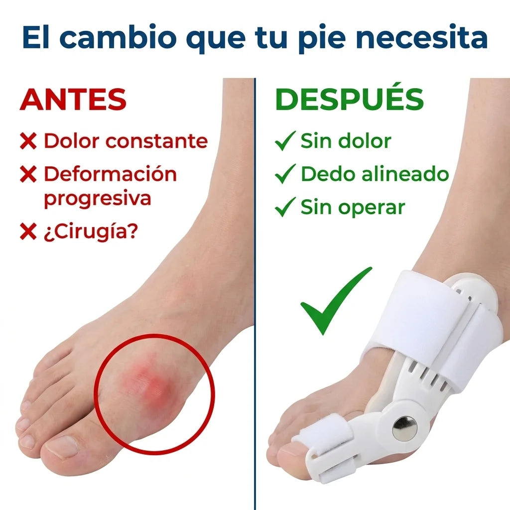 Comparativa antes y después con el corrector de juanetes