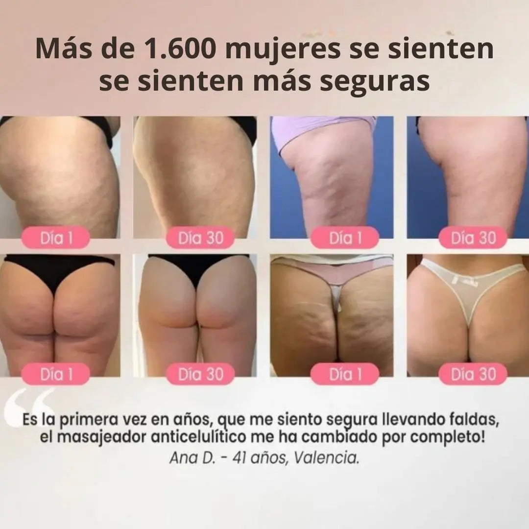 Masajeador corporal anticelulitis