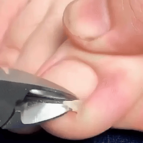 Cortador de uñas encarnadas